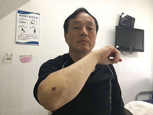 花果山车被撞,花果山被山地车撞