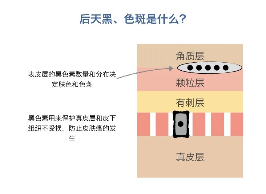 用了1000瓶美白精华也白不了？这难道就是所谓的“无效美白”