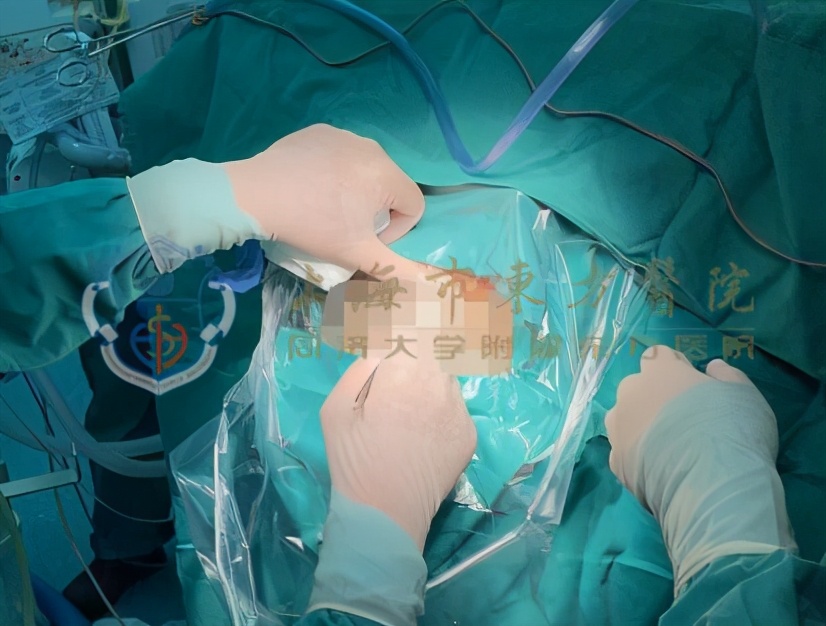 家人患精神分裂不吃药,家有精神分裂症患者怎么办