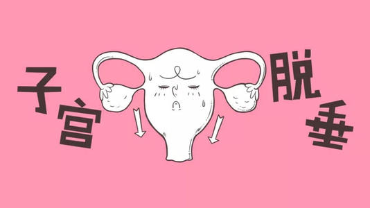 子宫脱垂中医治疗用什么药,子宫脱垂中医最好的治疗办法