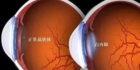 紫外线杀菌怎么杀的,紫外线怎么杀死支原体