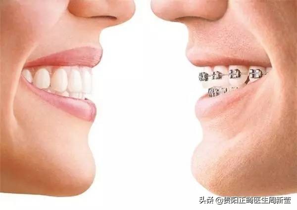 各类口腔治疗后的注意事项,口腔养护的基本方法和操作