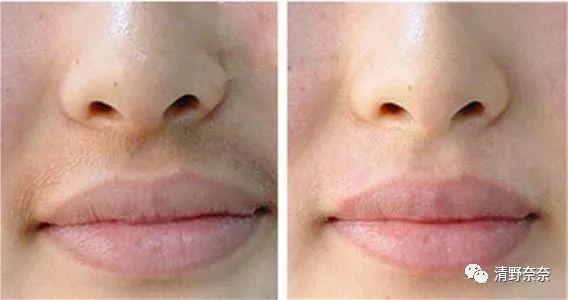 方脸短下巴难看,方圆脸怎么改善脸型下颚线高