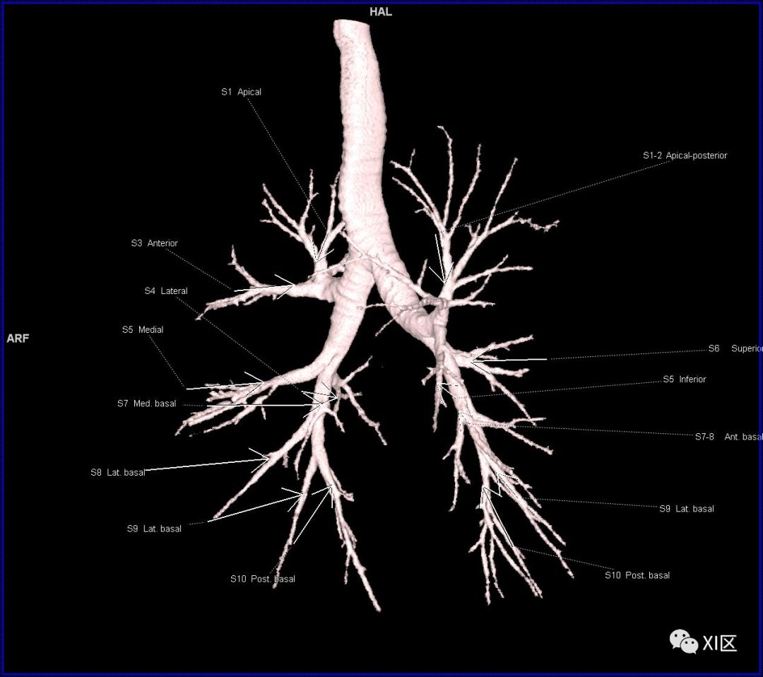 如此详细的肺部影像解剖，有点儿酷！