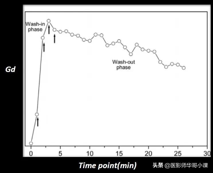 飞利浦磁共振系统界面及操作流程,飞利浦磁共振技术学习
