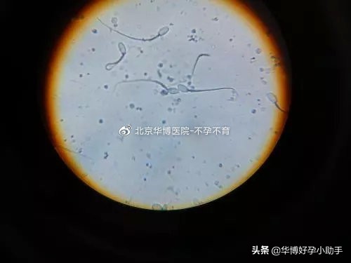 精液量特别少，是病吗？会不会影响生育？