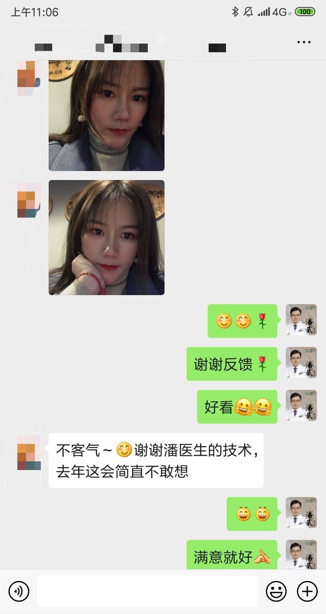 上海马大哈姑娘，稀里糊涂整了容，术后就一个字：丑