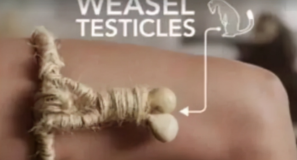 奇葩人类避孕史，*体下**塞鳄鱼粪便，贝壳做避孕套，戴黄鼠狼*丸睾**