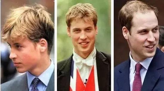 防脱的几种情况,防脱问题图