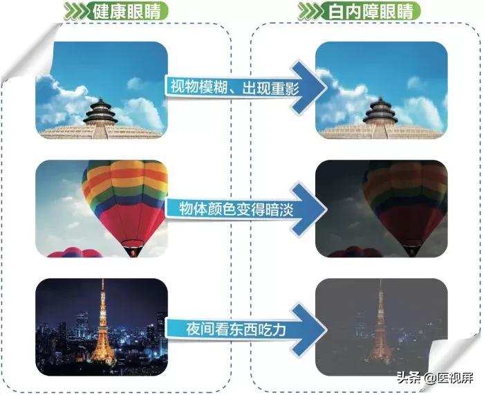 白内障不及时治疗会怎样,白内障不及时治疗有什么后果