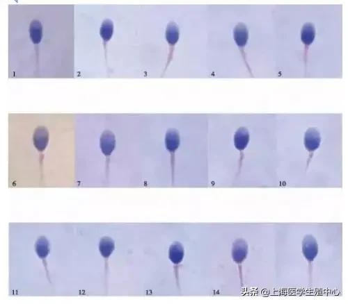 通过精子颜色可以看出精子质量吗,精子质量主要看哪几个指标