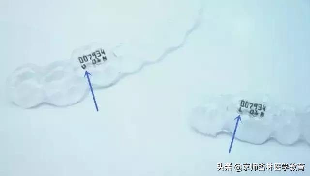 隐形牙套必备物品,隐形牙套整牙必备物品