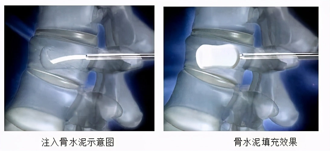 翻身疼深呼吸疼是怎么回事,向左翻身疼是怎么回事