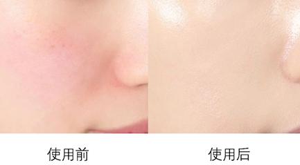 黄一琳等明星们都靠它美美美，女明星的美容养肤秘诀真的有效嘛？