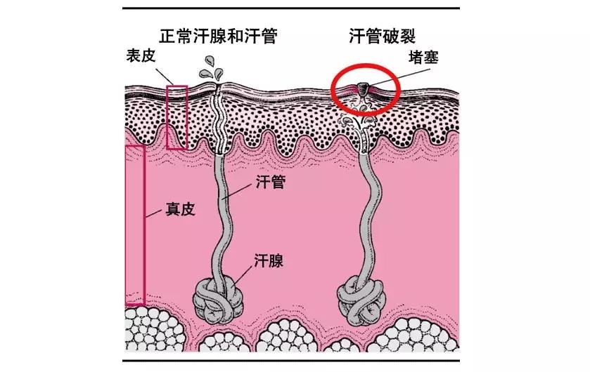 新生儿皮肤问题大全一览表,新生儿常见八大皮肤问题