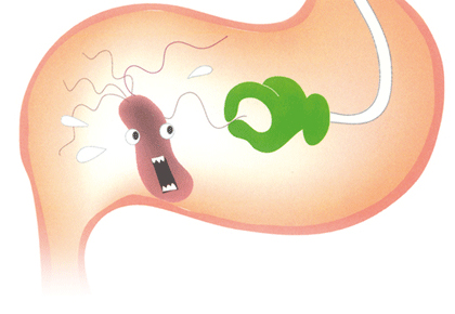 幽门螺杆菌hp两个+是什么意思,幽门螺旋杆菌与hp的区别