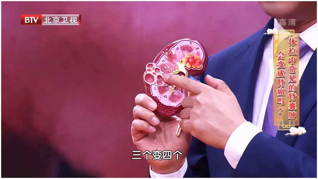 体检发现囊肿还需要找医生看吗,为什么切除囊肿反而会引起癌变