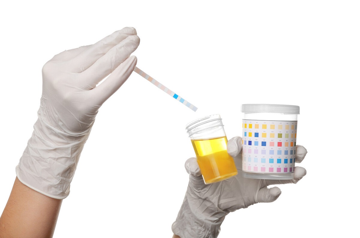 尿隐血有加号红细胞高怎么回事,尿隐血一定是肾出问题了吗