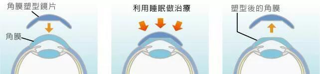 眼镜店知识视频,眼镜店的门道