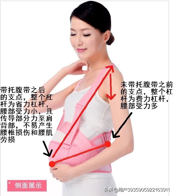 无痛分娩之后腰痛是后遗症吗,无痛分娩以后腰痛是怎么回事