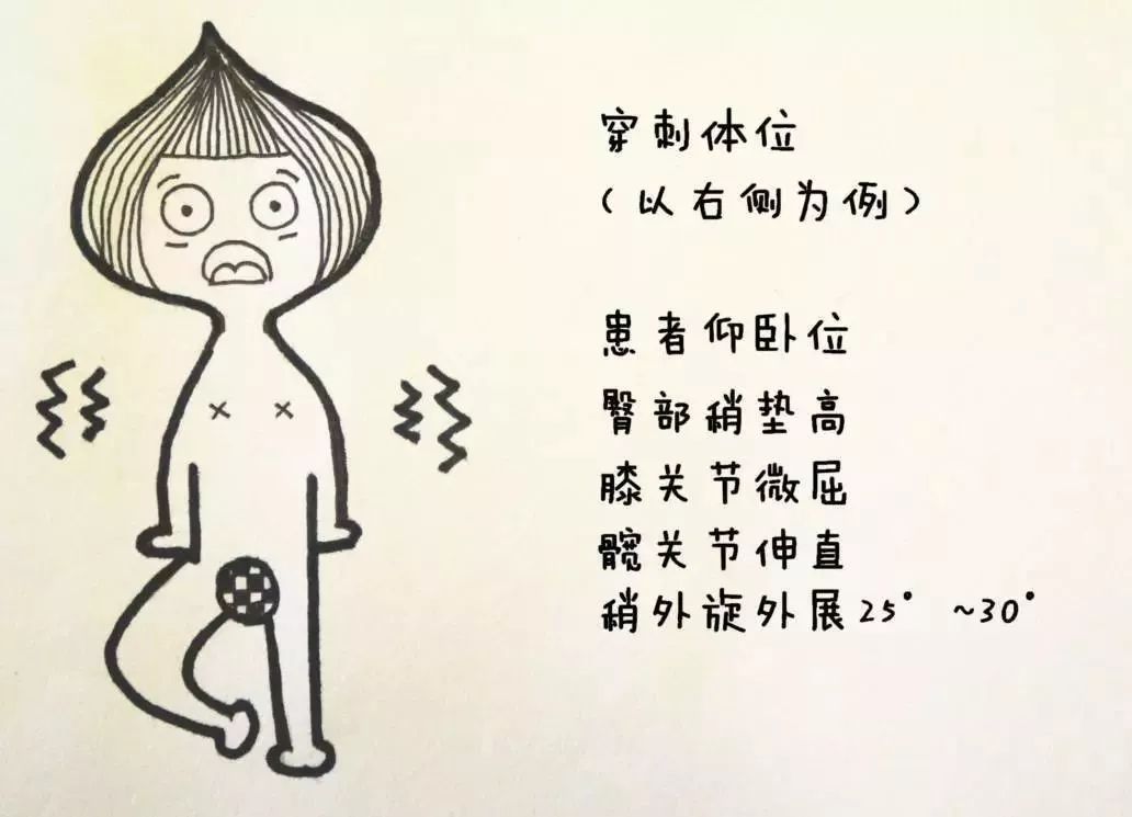 股静脉穿刺置管输液,股静脉穿刺置管术详细讲解