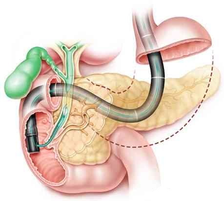 医生不会告诉你的10大秘密,医生不会告诉你眼科的秘密