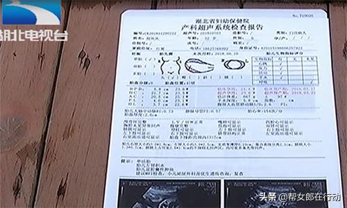 胎儿畸形引产怎么跟别人说,产检发现胎儿缺陷要不要引产