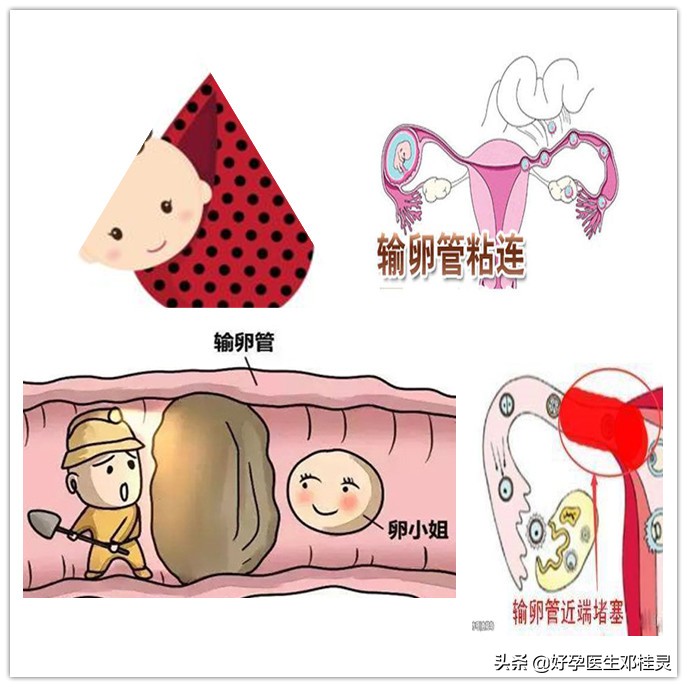 复查输卵管是否通畅必须做造影吗,检查输卵管通畅有必要查宫腔镜吗