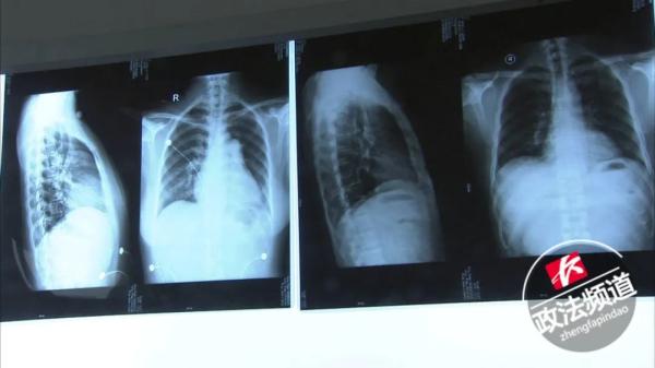 “穿着纸尿裤的女孩们，正在悄悄花钱买死”