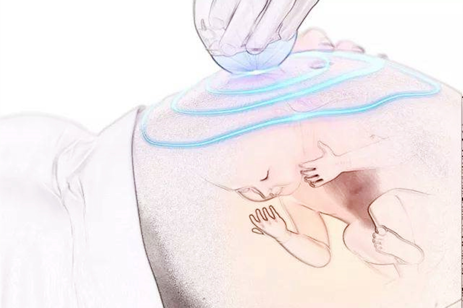 四维彩超能看出宝宝什么信息,四维彩超怎么看出胎儿的信息