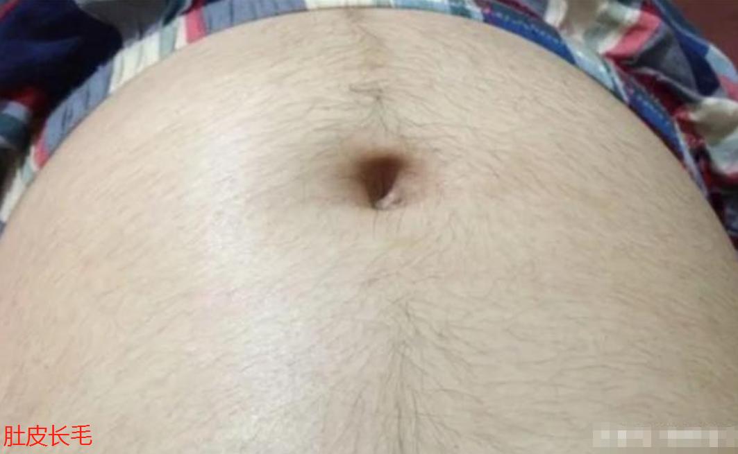 准妈妈怀孕肚皮上为啥会长毛？老人说是怀男宝的征兆，是真的吗？