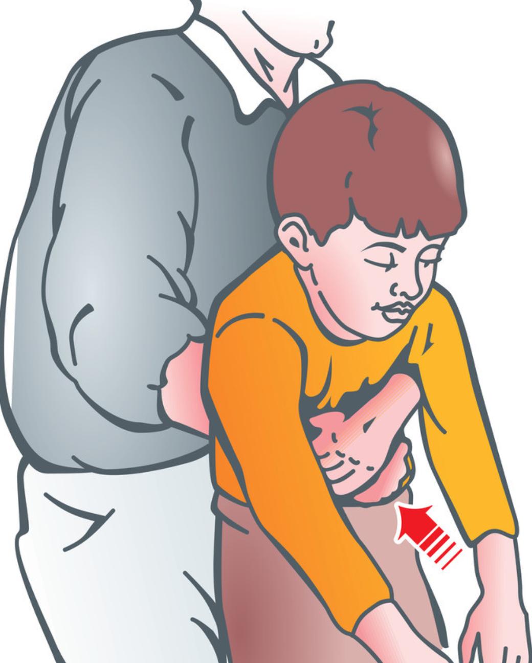 小孩吃东西卡住正确处理方法,小孩吃东西卡住急救视频教学