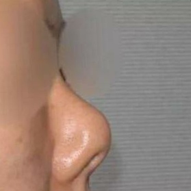 塌鼻好看的明星,哪些明星的鼻子是蒜头鼻和塌鼻子