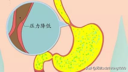 总是反酸烧心要注意什么,老是在半夜反酸烧心是怎么回事