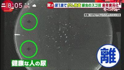 确诊食管癌还有可能是良性的吗,确诊食道癌后还需要活检吗