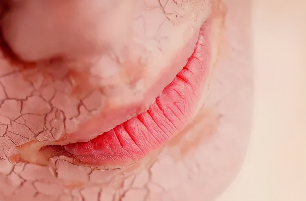 太坑了!领导竟然让我手动挑杂质,三天后开始疯狂脱皮