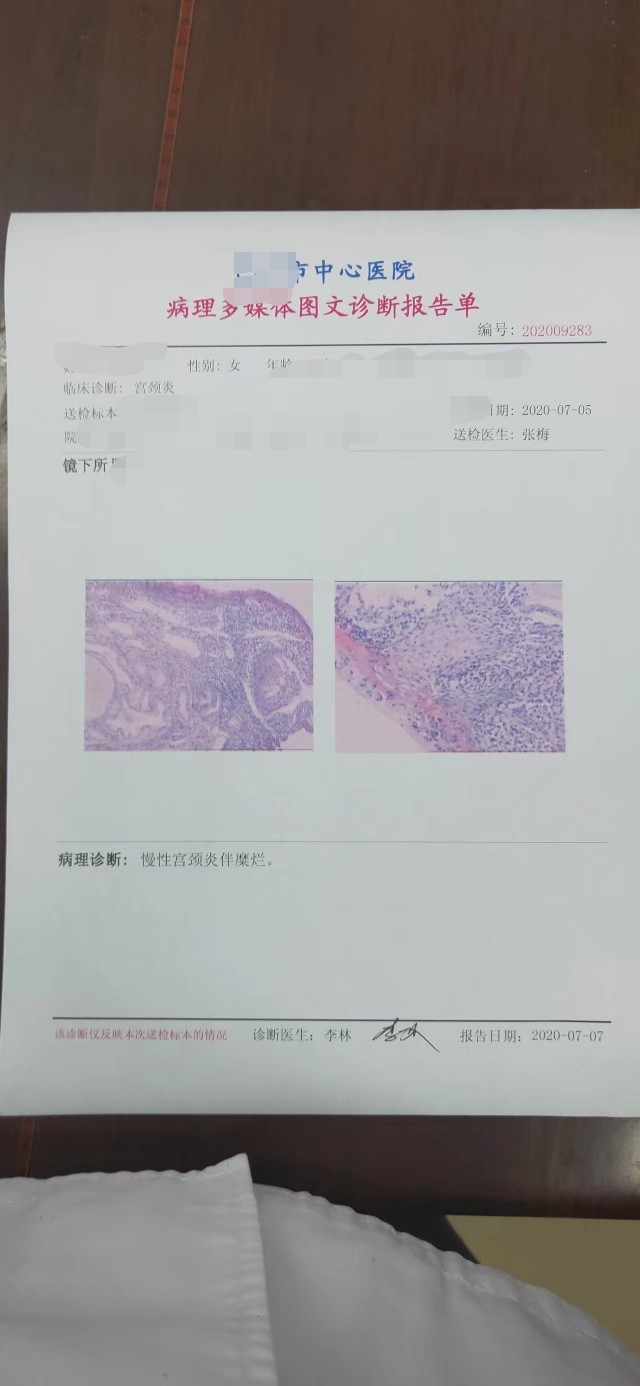 女人有妇科困扰吗,女人常见的妇科问题