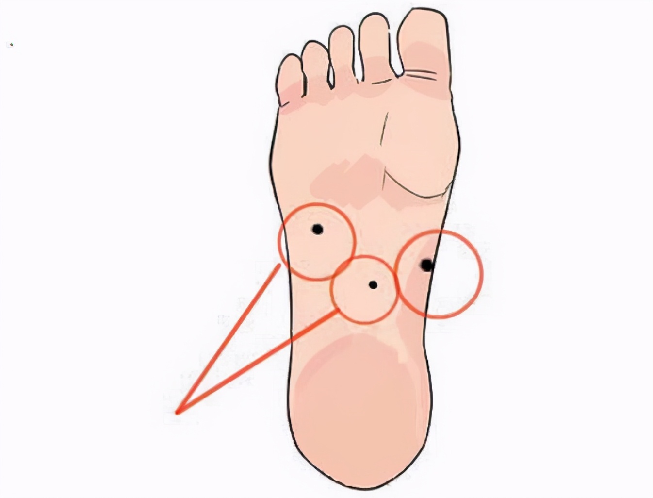 脚底黑色素痣病理结果有癌变,脚趾黑色素痣会很快恶变吗