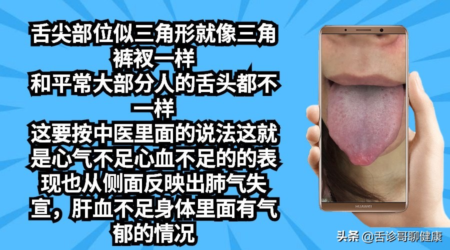 舌诊哥聊健康痰湿,抖音舌诊哥舌象分析与感悟