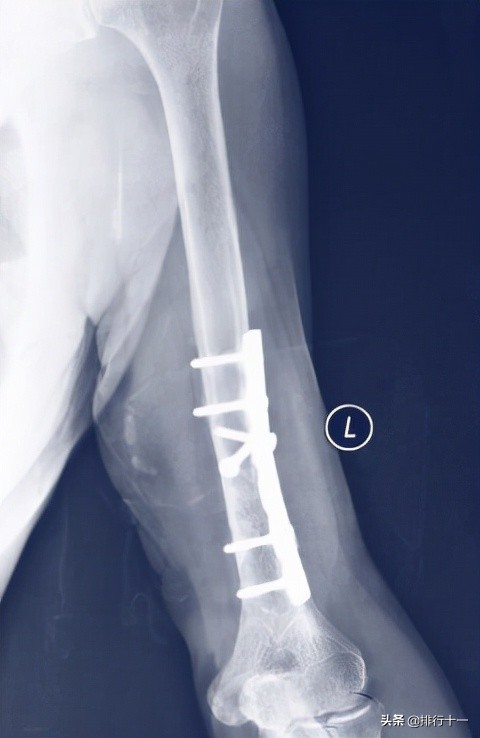 镁的用途及未来的发展前景,镁发展历史