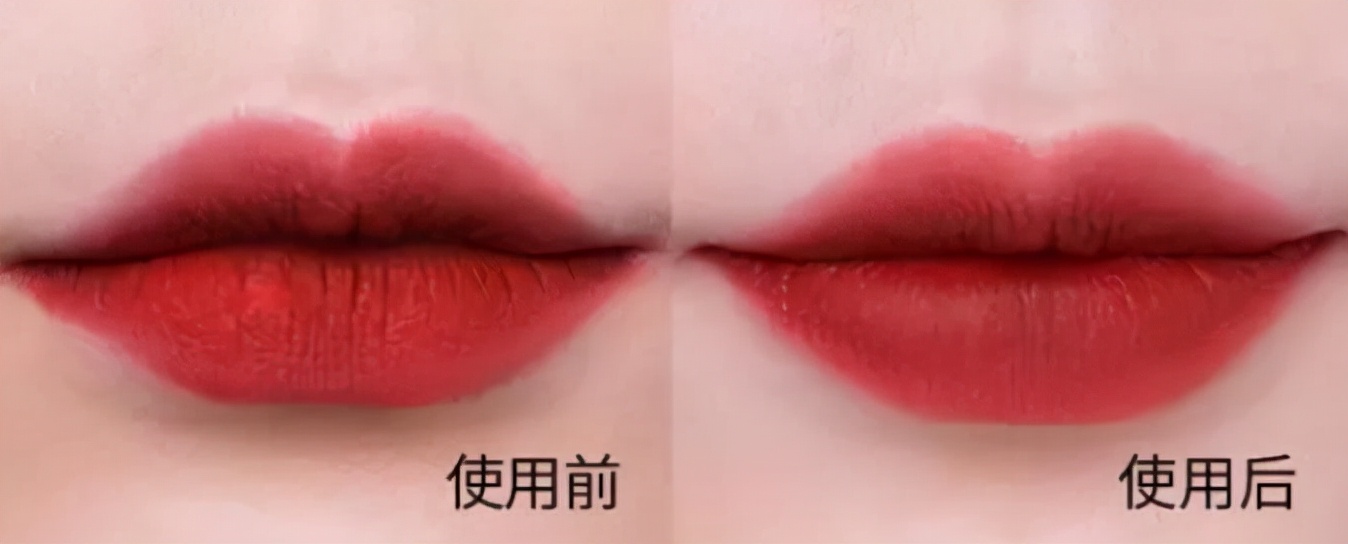 小孩长期嘴唇干裂起皮还出血,儿童嘴唇起皮干裂出血怎么办