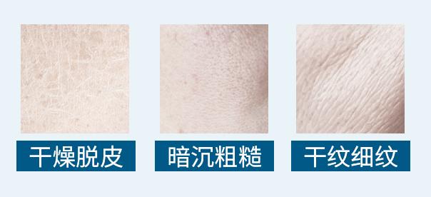 女人打玻尿酸的表现,女人经常打玻尿酸10年