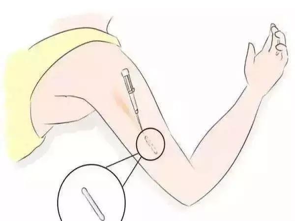 不想再生了怎么避孕好,不想再生了怎样避孕的方法最好