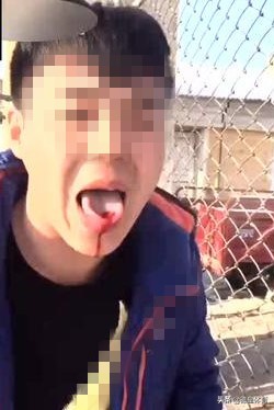 北方冬天的运动,北方冬天舔栏杆