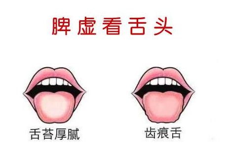 小儿推拿治疗宝宝脾胃疾病,值得收藏