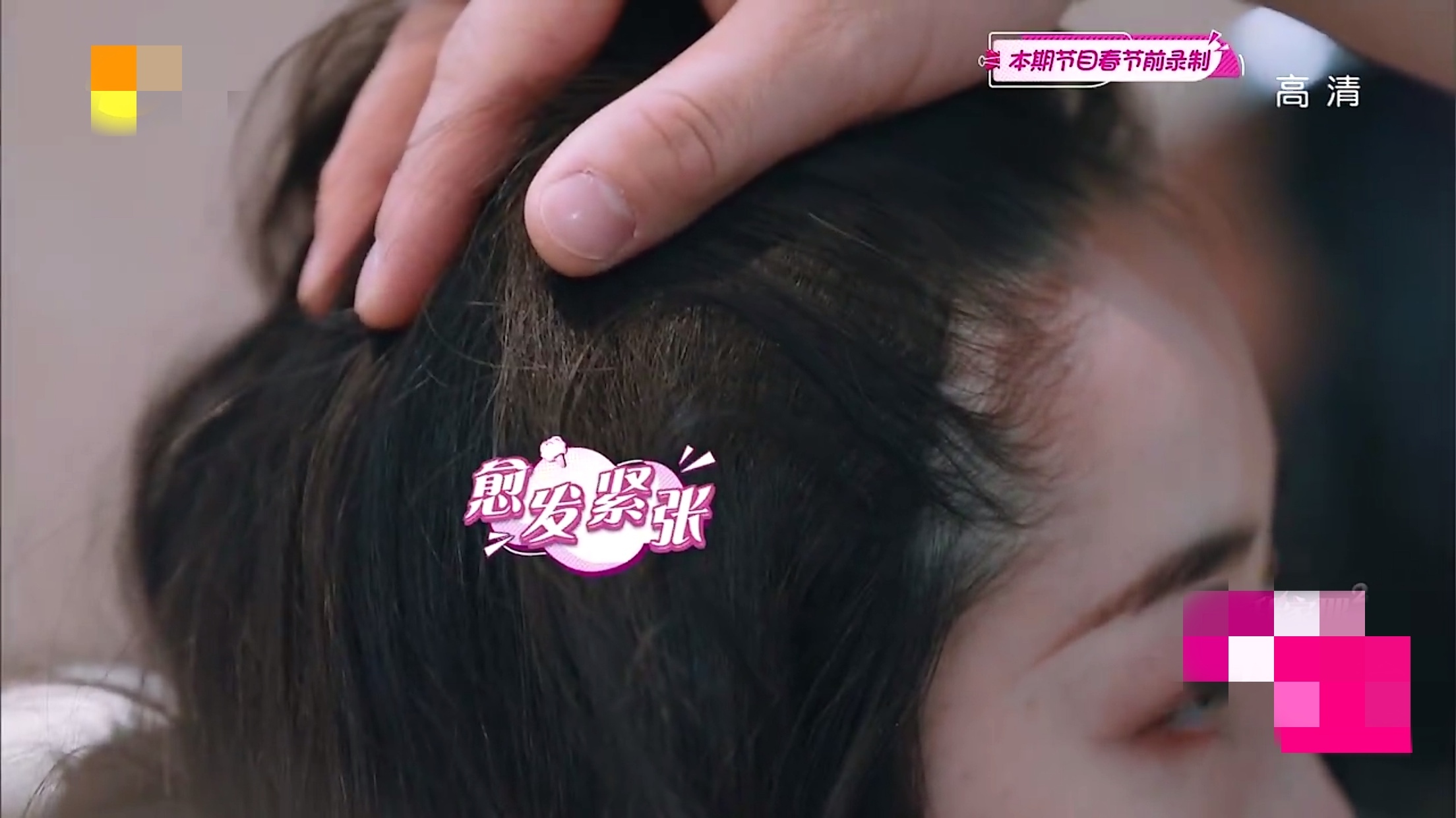 蒋梦婕植发是哪一期,蒋梦婕植发视频完整版