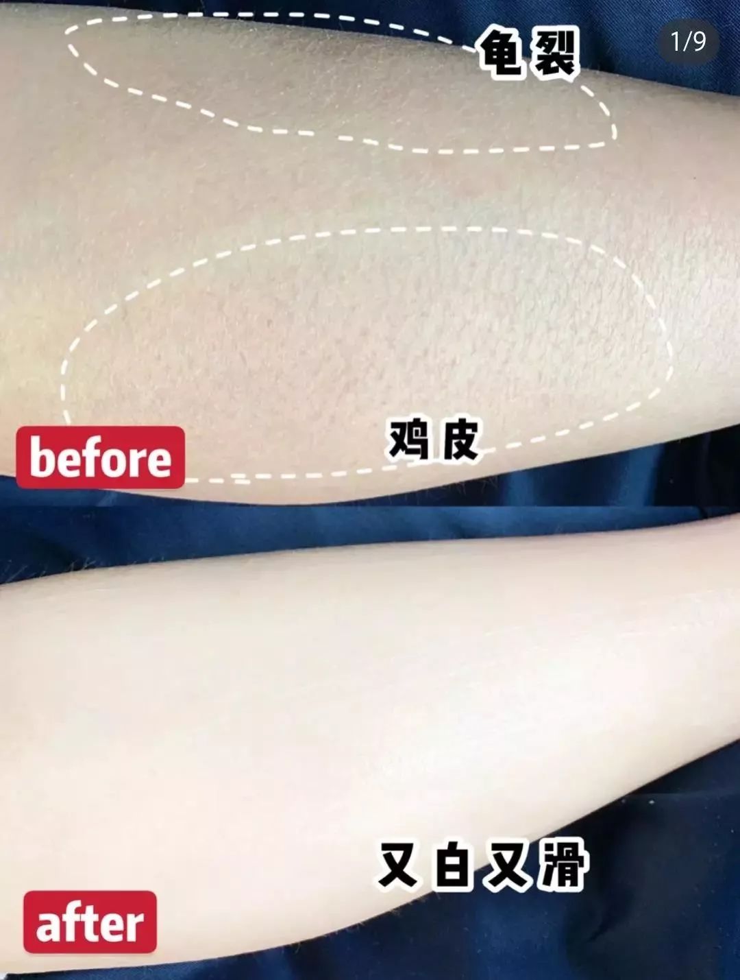 张韶涵如何抗糖,张韶涵抗老秘密