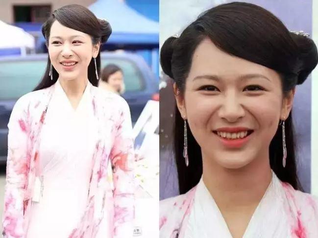 如何用双眼皮贴拯救泪沟法令纹,脸上有法令纹怎么拯救