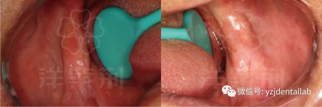 病例教学视频,病例分析操作技能