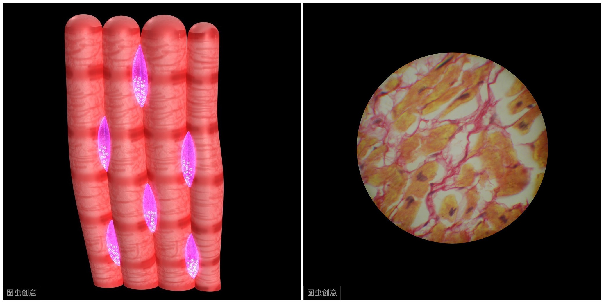 心肌重构能够有效逆转吗,心梗后多长时间心肌重构